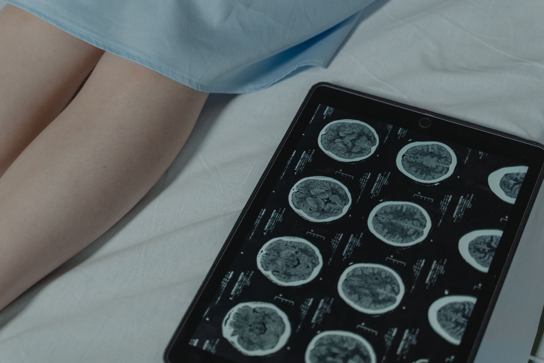Scanner cérébral analysé sur une tablette médicale