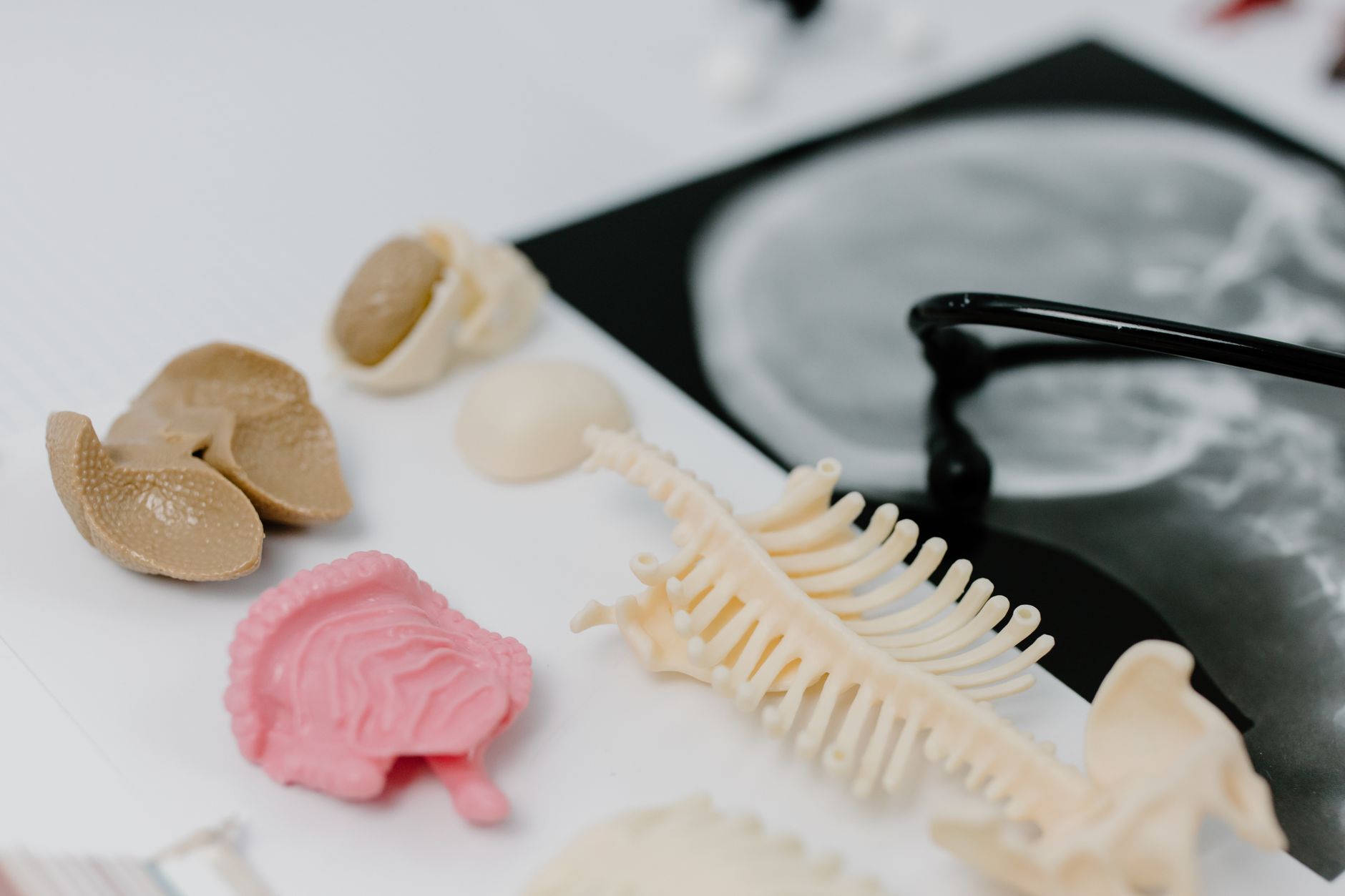 Modèle anatomique de colonne vertébrale et radiographie