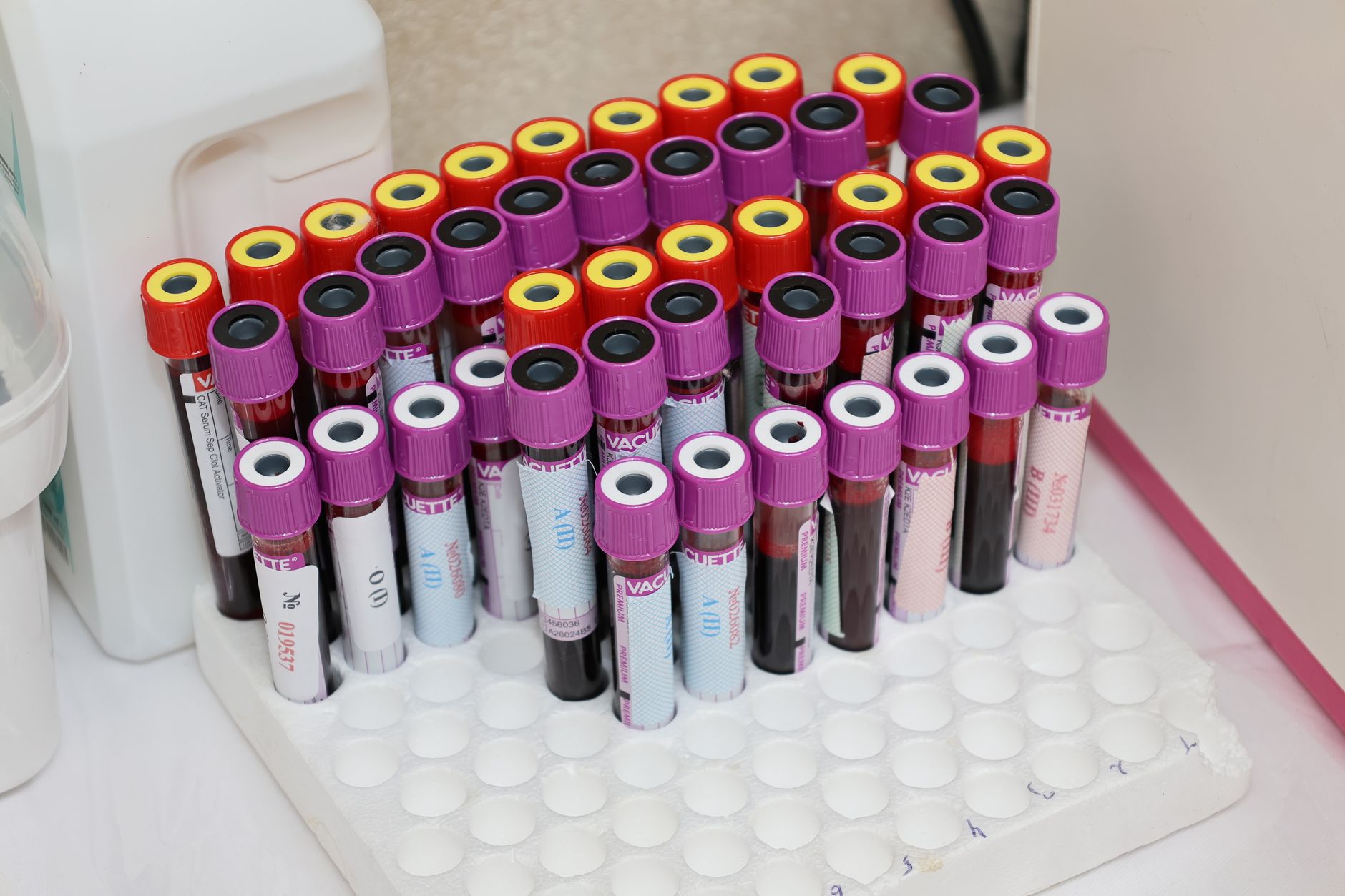 Rangées de tubes de prélèvement dans un laboratoire d’analyses